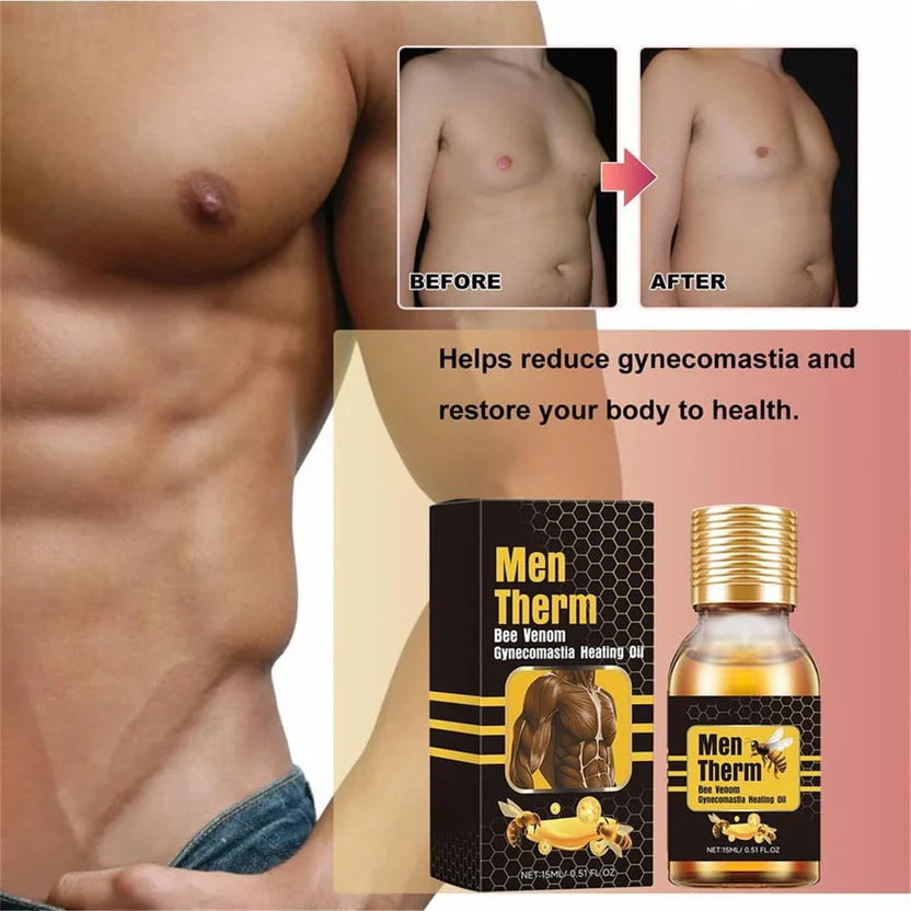 Chest Fat Bee Venom Gynecomastia Heating Oil