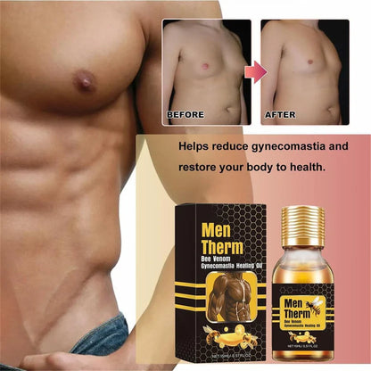 Chest Fat Bee Venom Gynecomastia Heating Oil